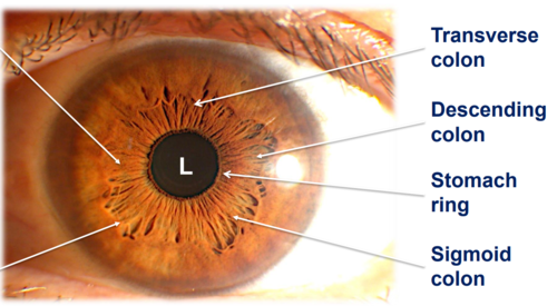 Chapter 3.2: The Intestinal Ring in Iridology