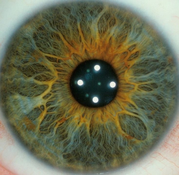 Iridology Knowledge Guide