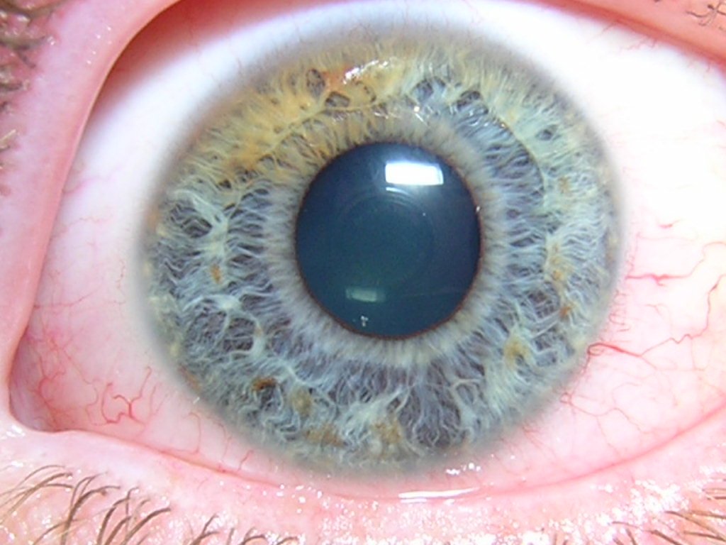 Chapter 2.2: Structure of the Iris