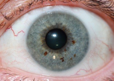 My Global Iridologist Salary Research: First-Hand Observations Across 6 Countries