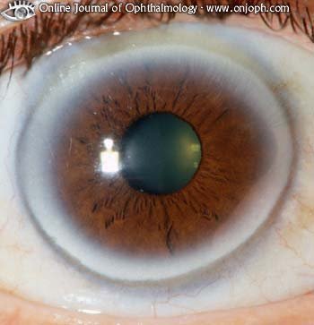 The Importance of Promoting Iridology