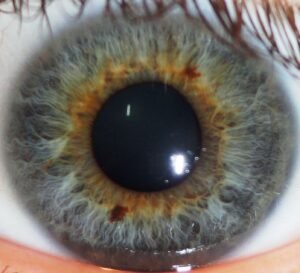 Chapter 2.4: The Relationship Between the Pupil and the Iris