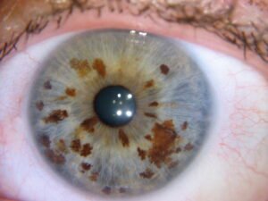 Chapter 2.4: The Relationship Between the Pupil and the Iris