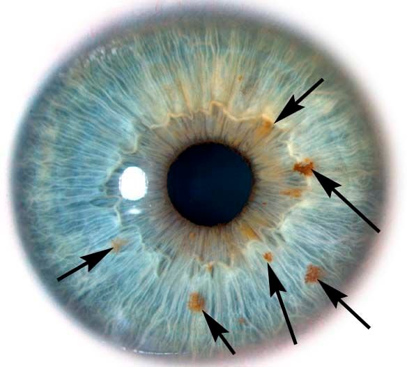 Chapter 2: Local Anatomy of the Eye