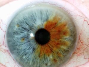 Chapter 2.3: The Color of the Iris