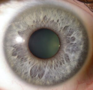 Chapter 2.3: The Color of the Iris