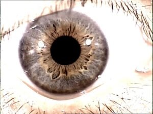 Chapter 2.3: The Color of the Iris