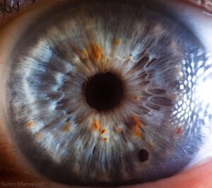 Chapter 2.3: The Color of the Iris