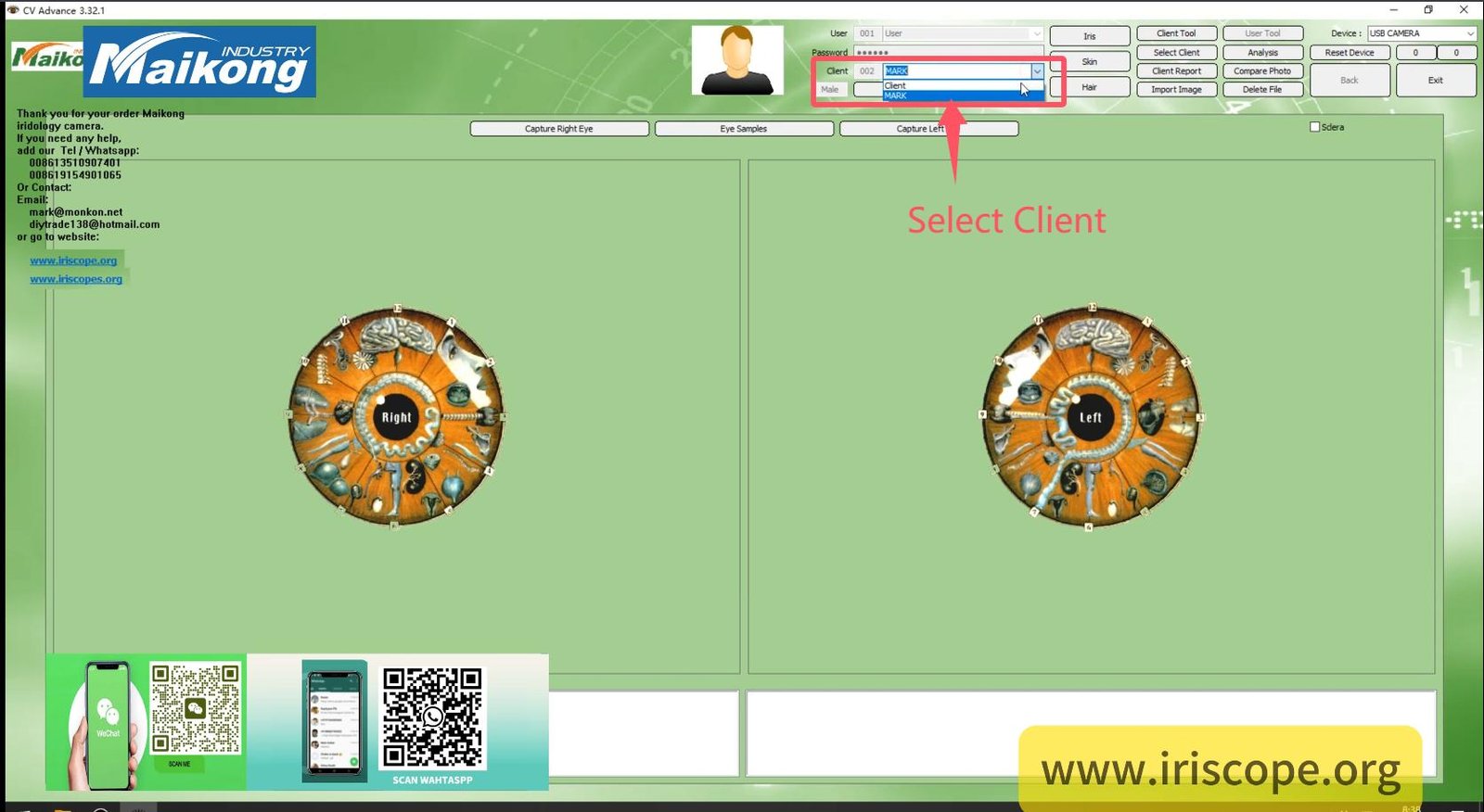 How To USE MAIKONG IRIDOLOGY SOFTWARE 2025 English Version 007