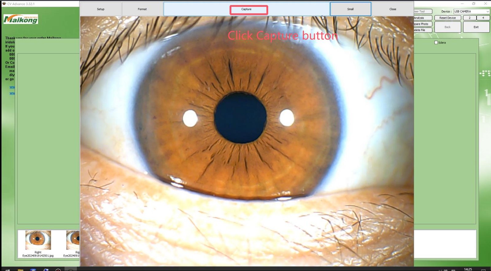 How To USE MAIKONG IRIDOLOGY SOFTWARE 2025 English Version 009