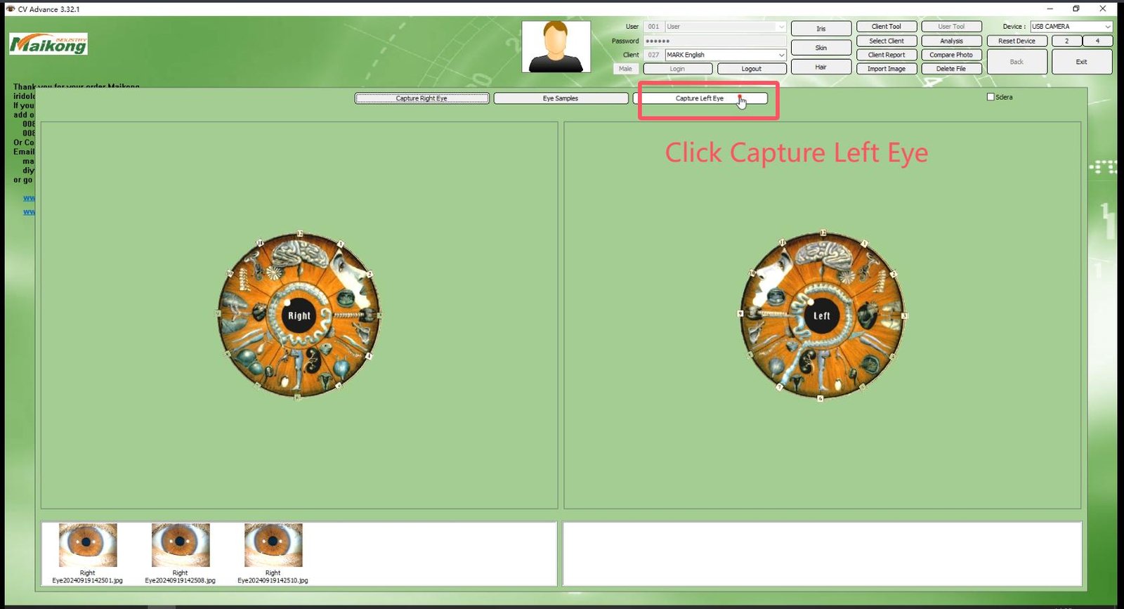 How To USE MAIKONG IRIDOLOGY SOFTWARE 2025 English Version 010