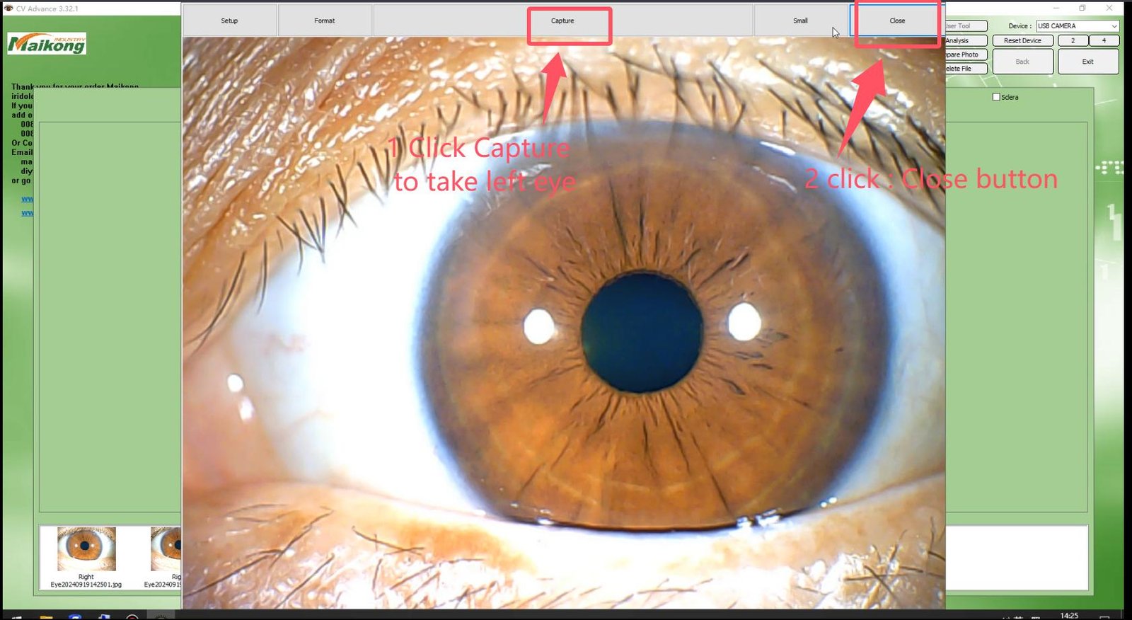 How To USE MAIKONG IRIDOLOGY SOFTWARE 2025 English Version 011