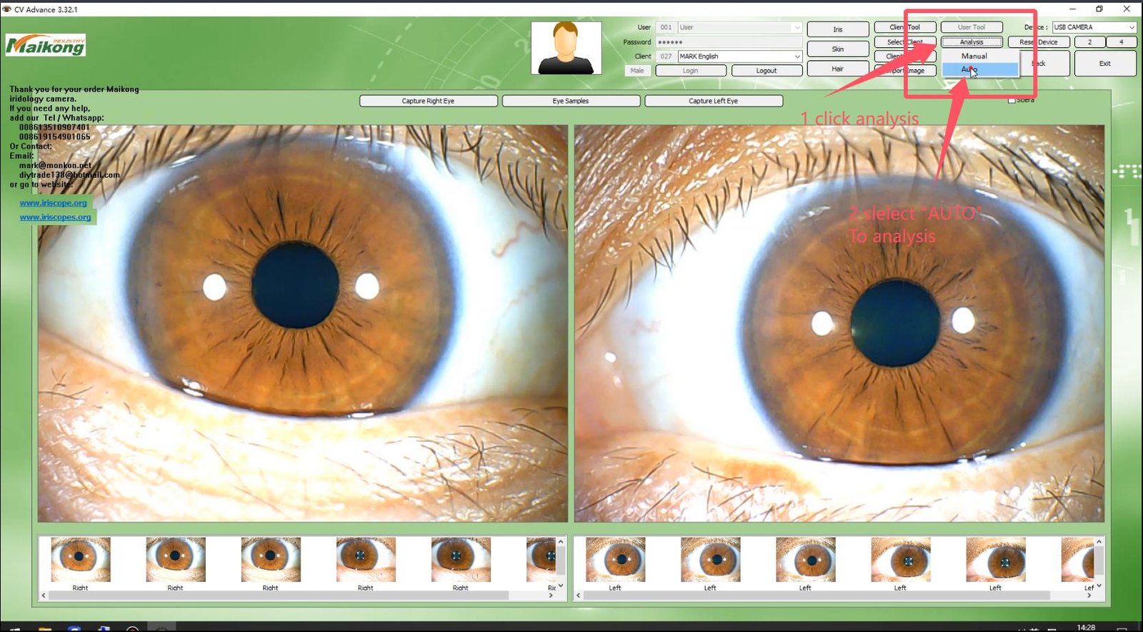 How To USE MAIKONG IRIDOLOGY SOFTWARE 2025 English Version 012