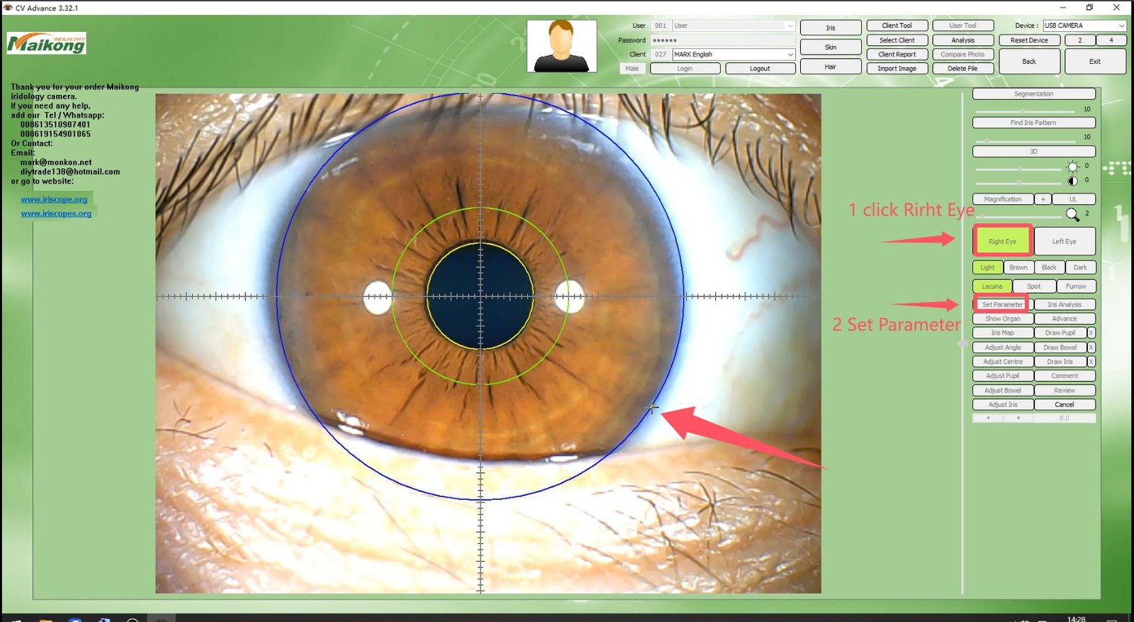 How To USE MAIKONG IRIDOLOGY SOFTWARE 2025 English Version 013