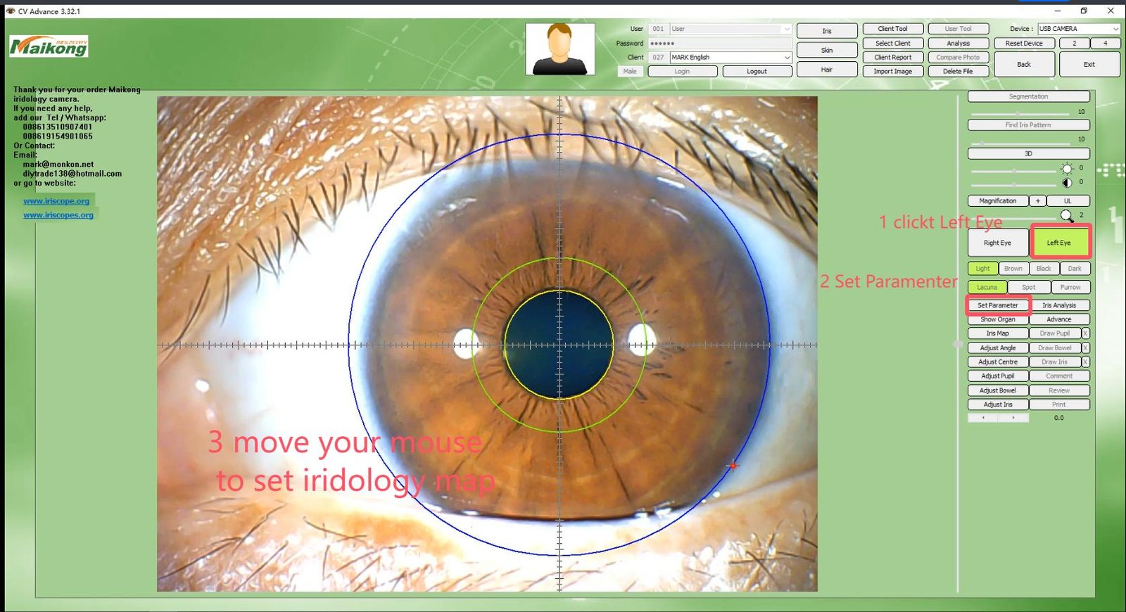 How To USE MAIKONG IRIDOLOGY SOFTWARE 2025 English Version 014