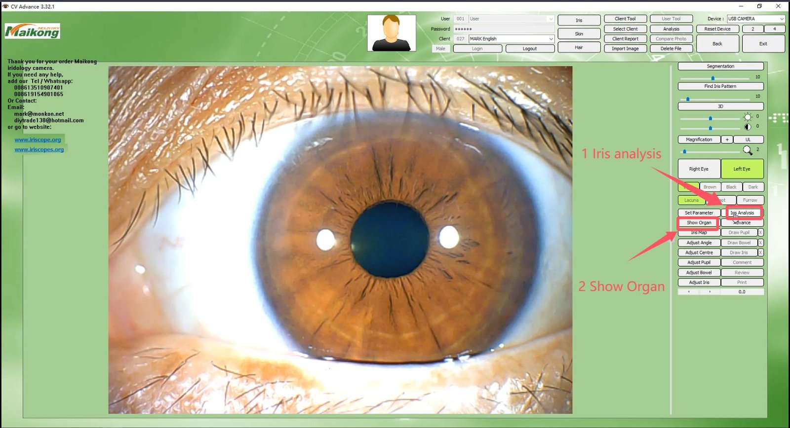 How To USE MAIKONG IRIDOLOGY SOFTWARE 2025 English Version 015