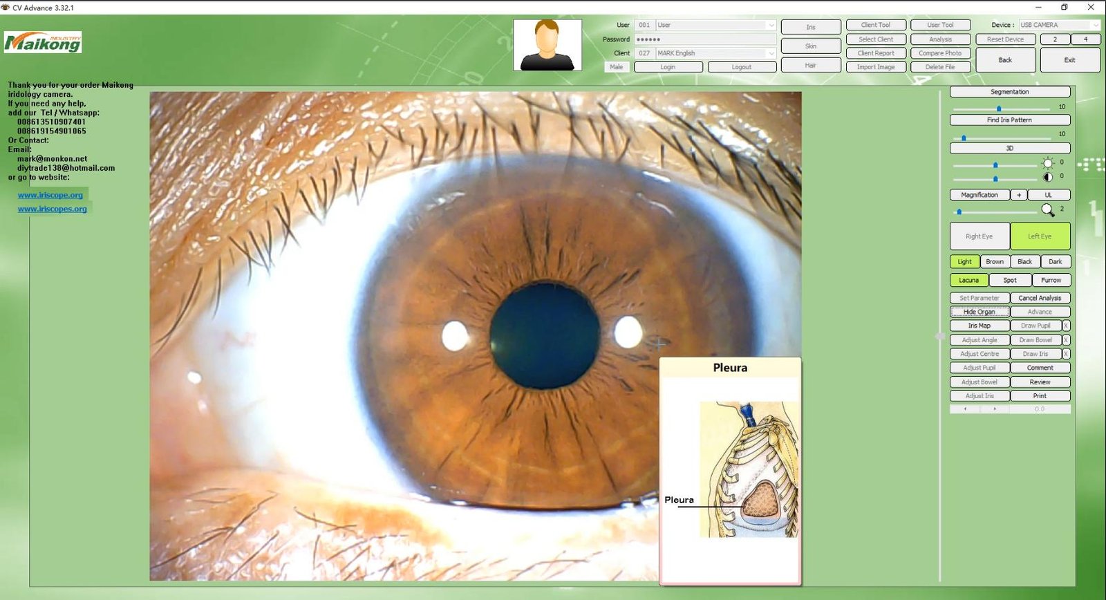 How To USE MAIKONG IRIDOLOGY SOFTWARE 2025 English Version 016