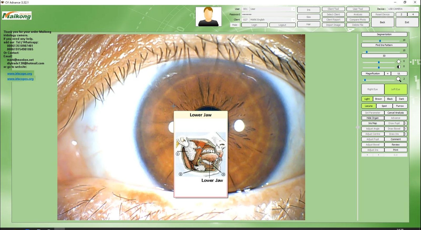 How To USE MAIKONG IRIDOLOGY SOFTWARE 2025 English Version 017