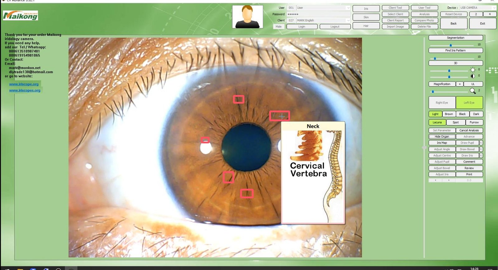 How To USE MAIKONG IRIDOLOGY SOFTWARE 2025 English Version 018