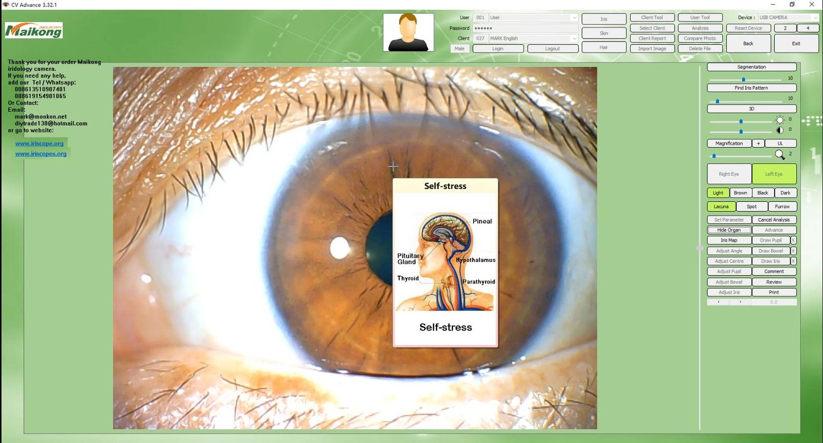 How To USE MAIKONG IRIDOLOGY SOFTWARE 2025 English Version 020