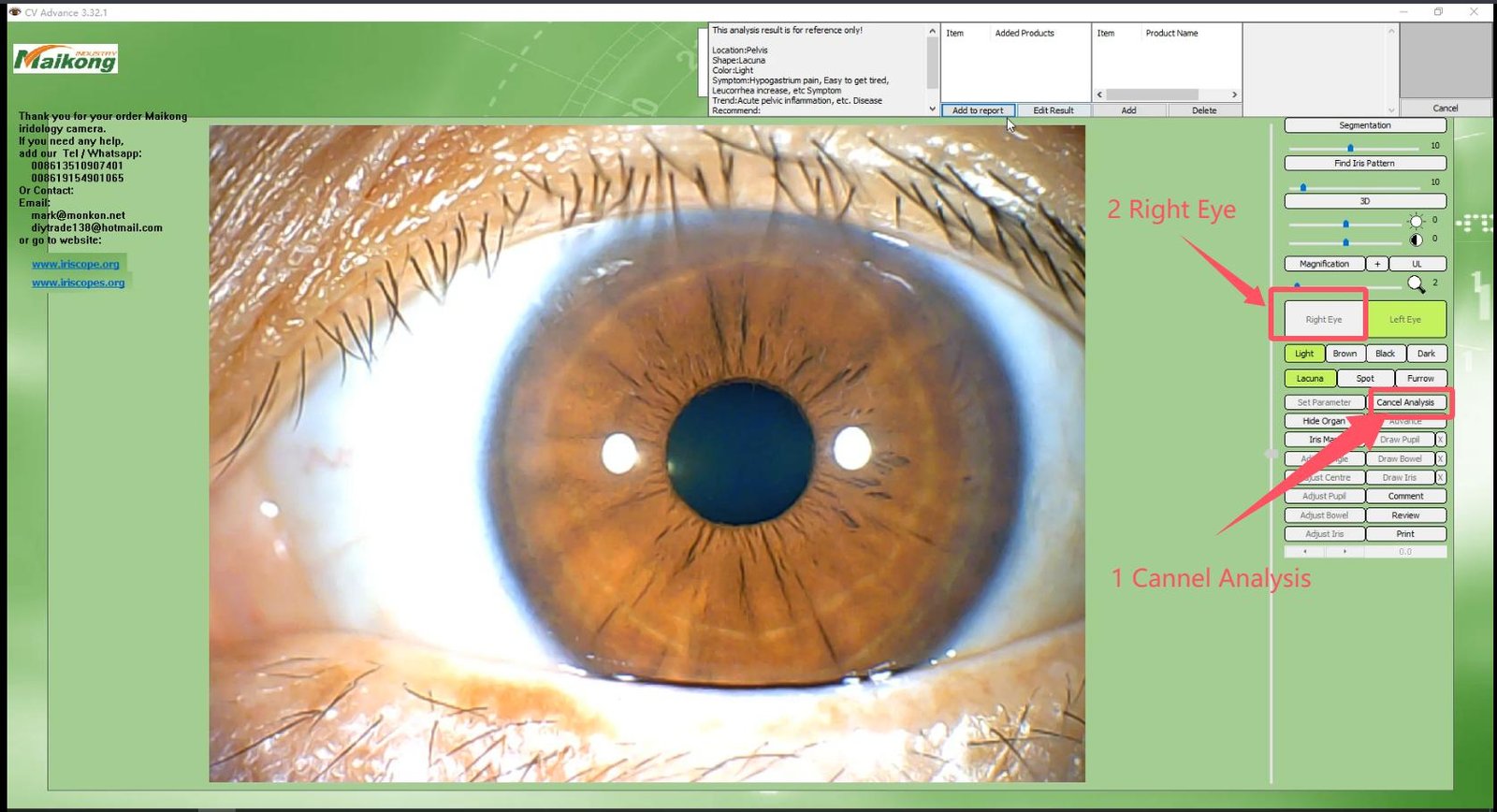 How To USE MAIKONG IRIDOLOGY SOFTWARE 2025 English Version 022