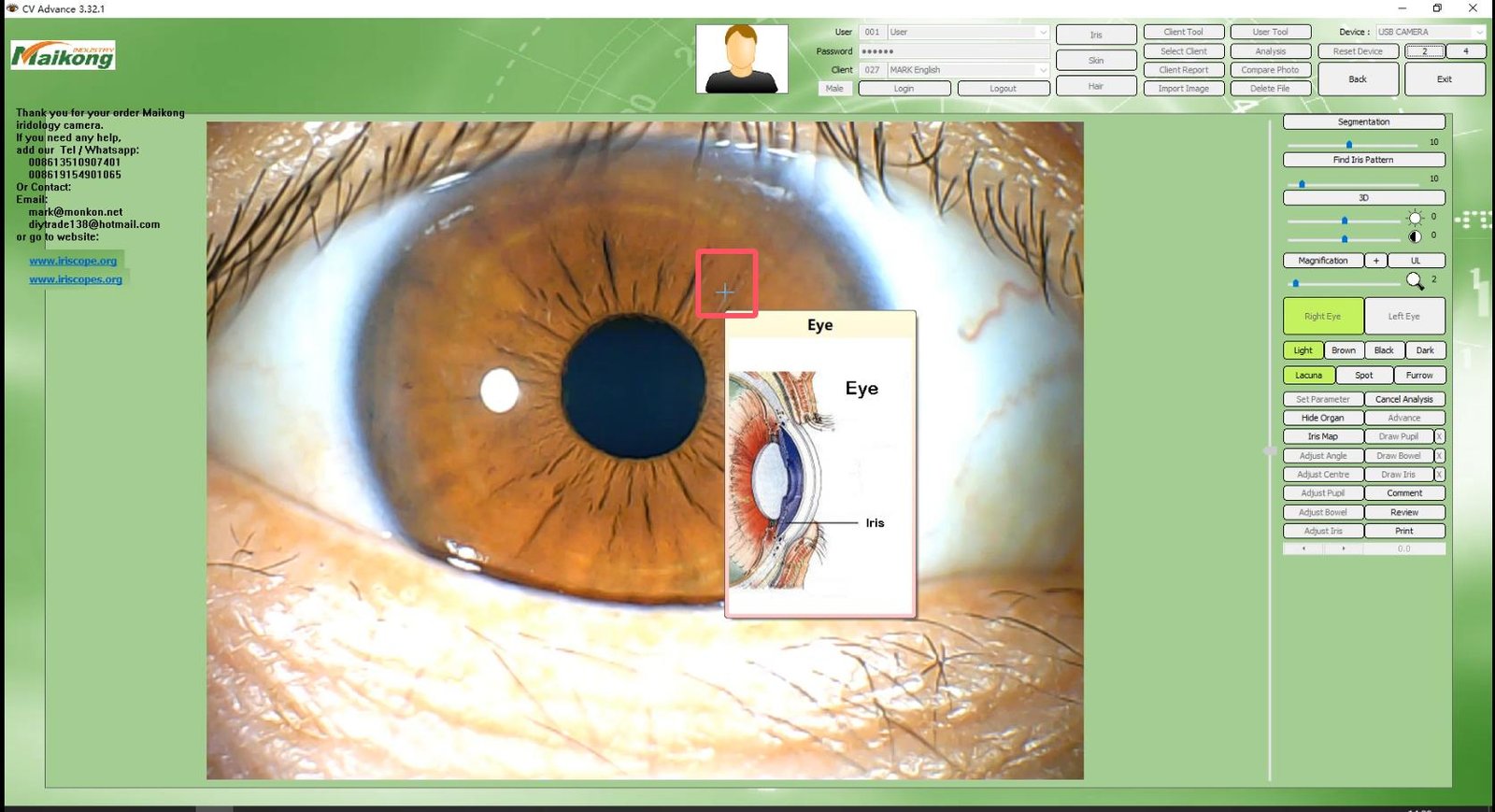 How To USE MAIKONG IRIDOLOGY SOFTWARE 2025 English Version 025