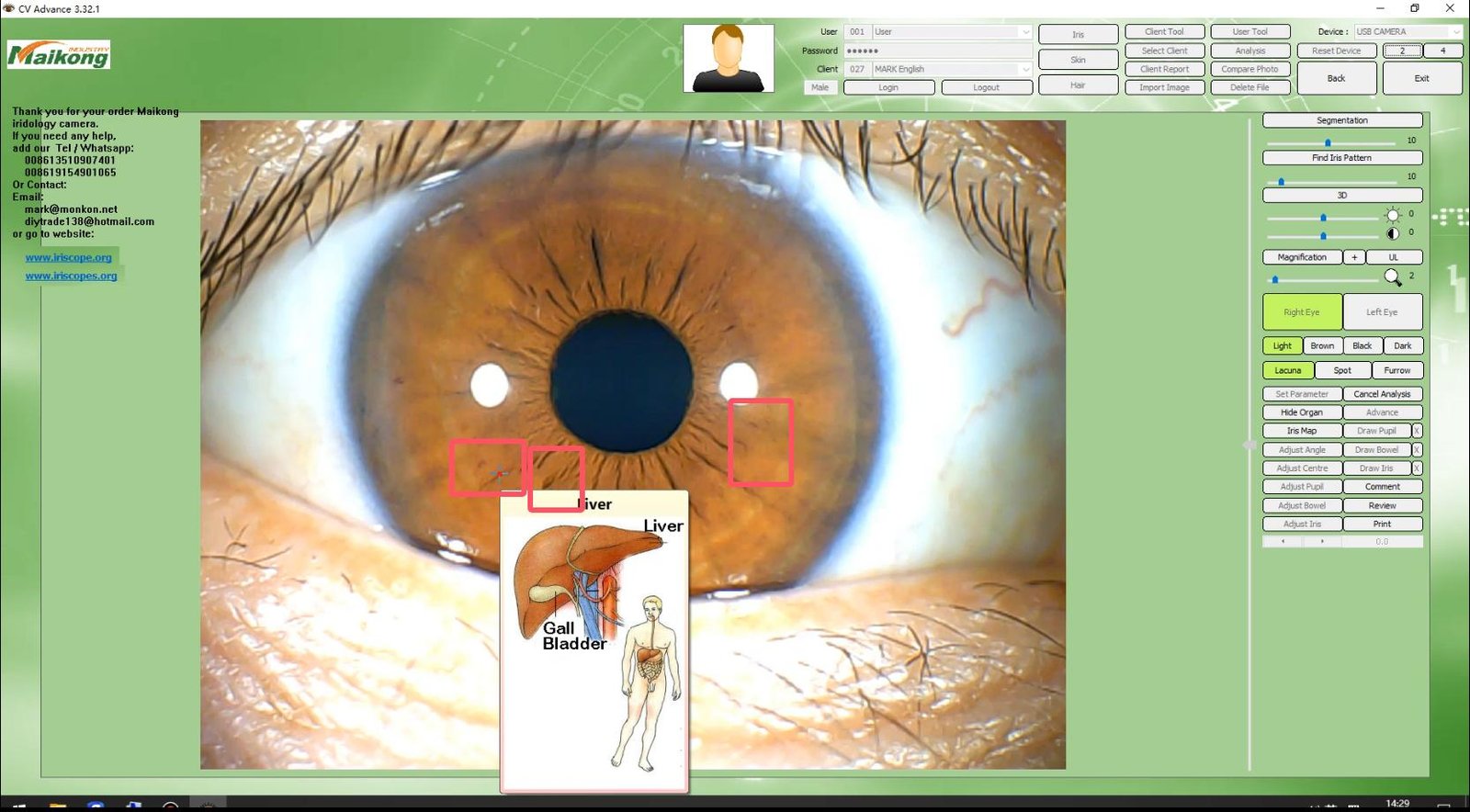 How To USE MAIKONG IRIDOLOGY SOFTWARE 2025 English Version 027