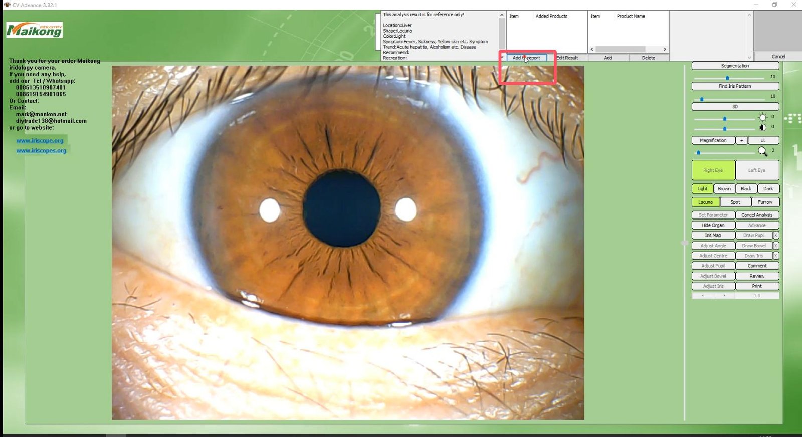 How To USE MAIKONG IRIDOLOGY SOFTWARE 2025 English Version 028