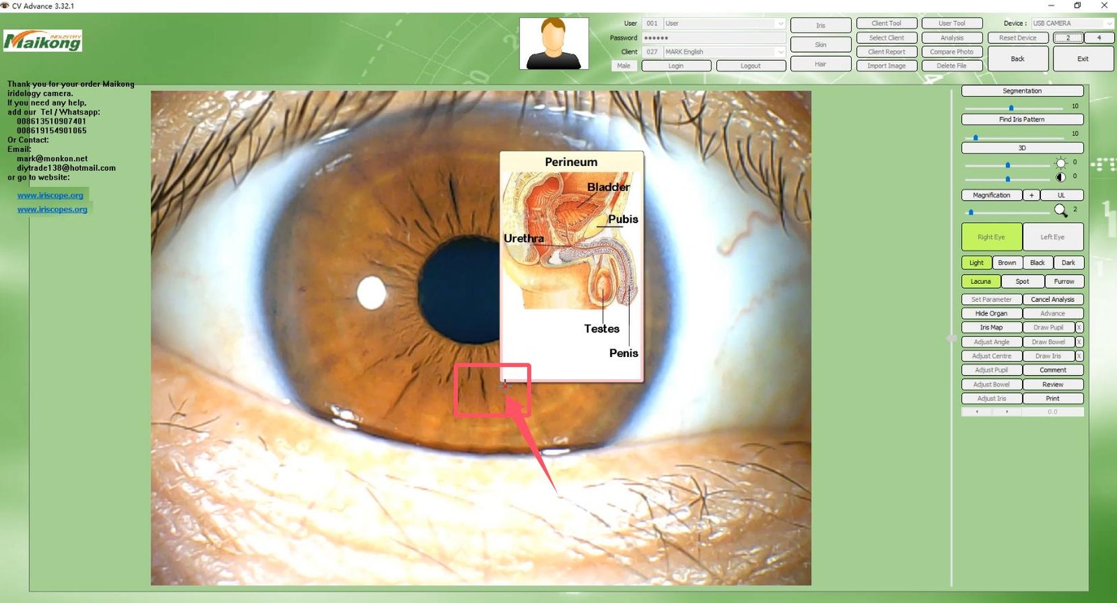 How To USE MAIKONG IRIDOLOGY SOFTWARE 2025 English Version 029