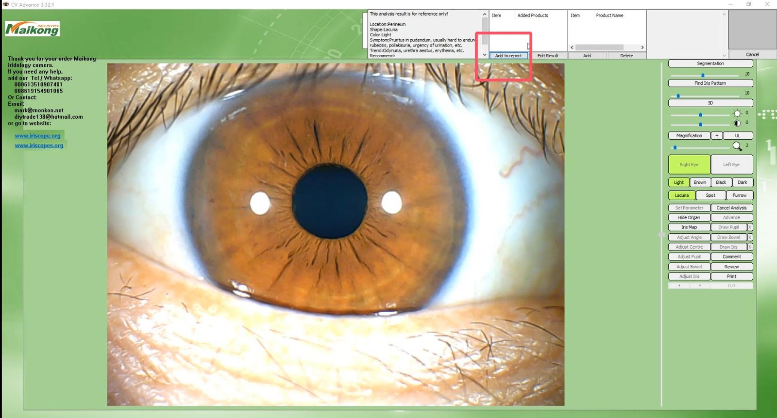 How To USE MAIKONG IRIDOLOGY SOFTWARE 2025 English Version 030