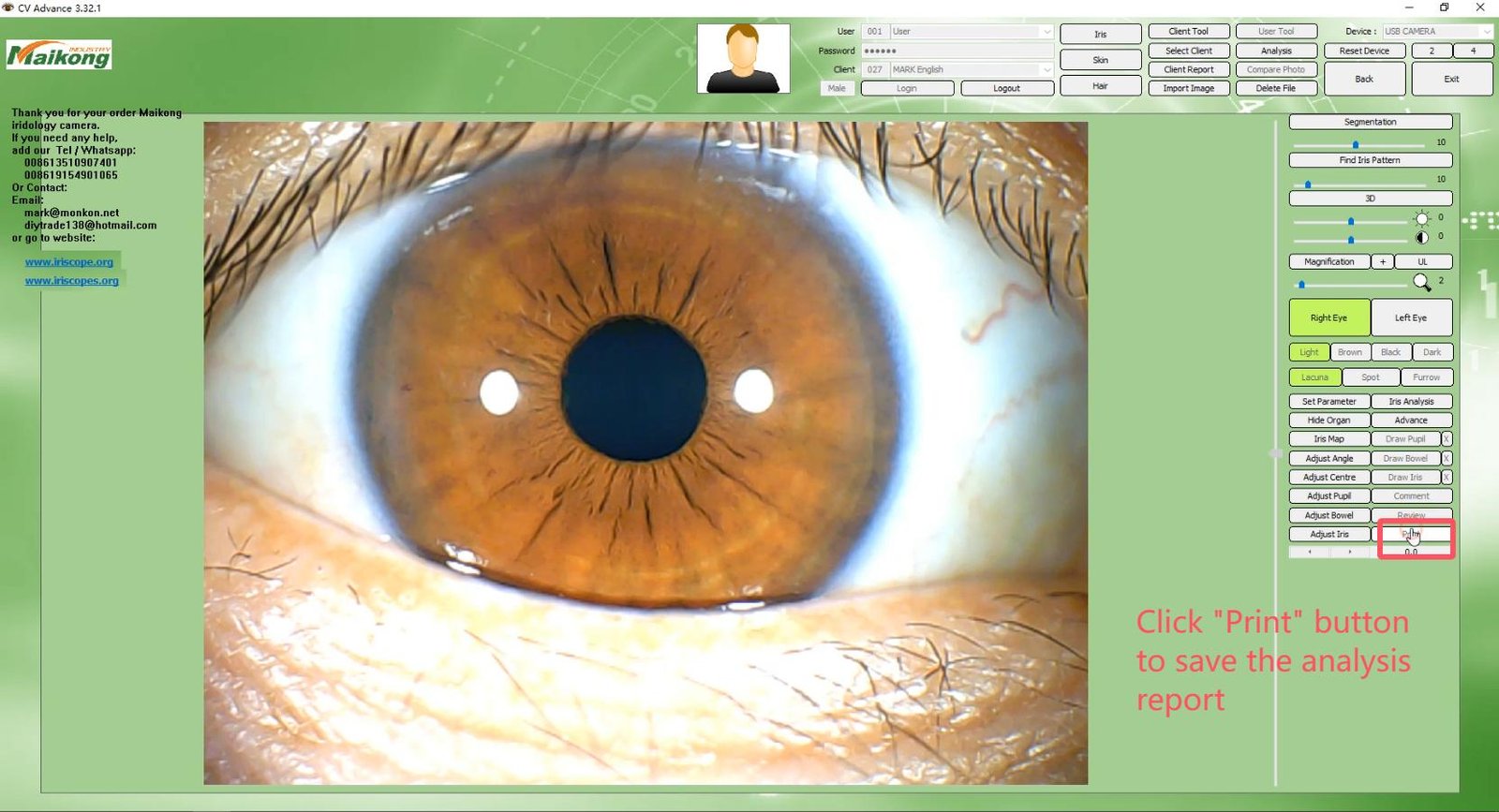 How To USE MAIKONG IRIDOLOGY SOFTWARE 2025 English Version 031