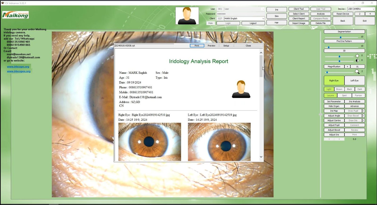 How To USE MAIKONG IRIDOLOGY SOFTWARE 2025 English Version 032