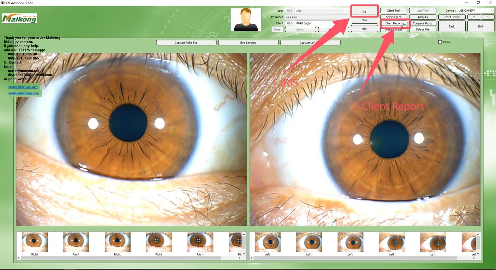 How To USE MAIKONG IRIDOLOGY SOFTWARE 2025 English Version 033