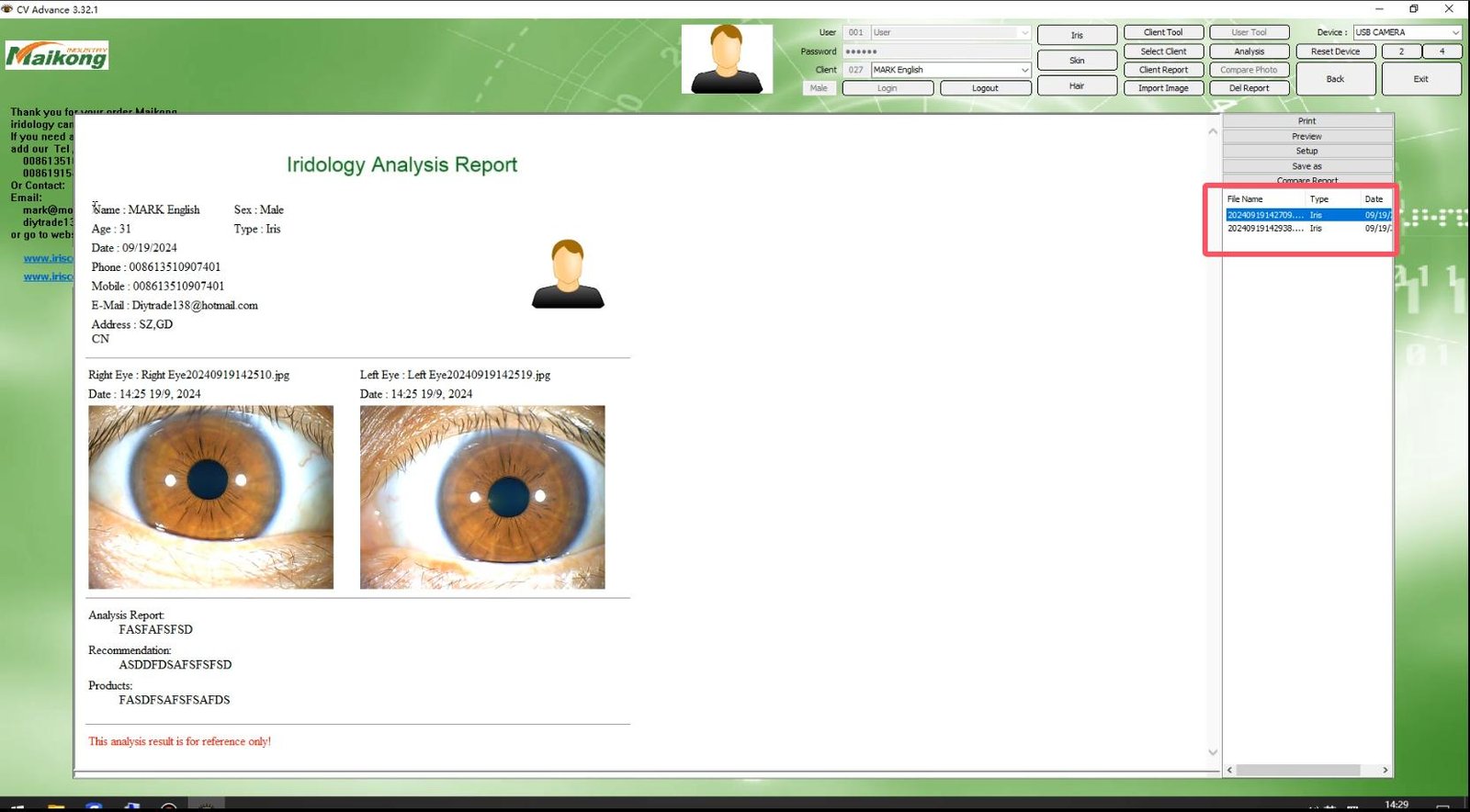 How To USE MAIKONG IRIDOLOGY SOFTWARE 2025 English Version 034