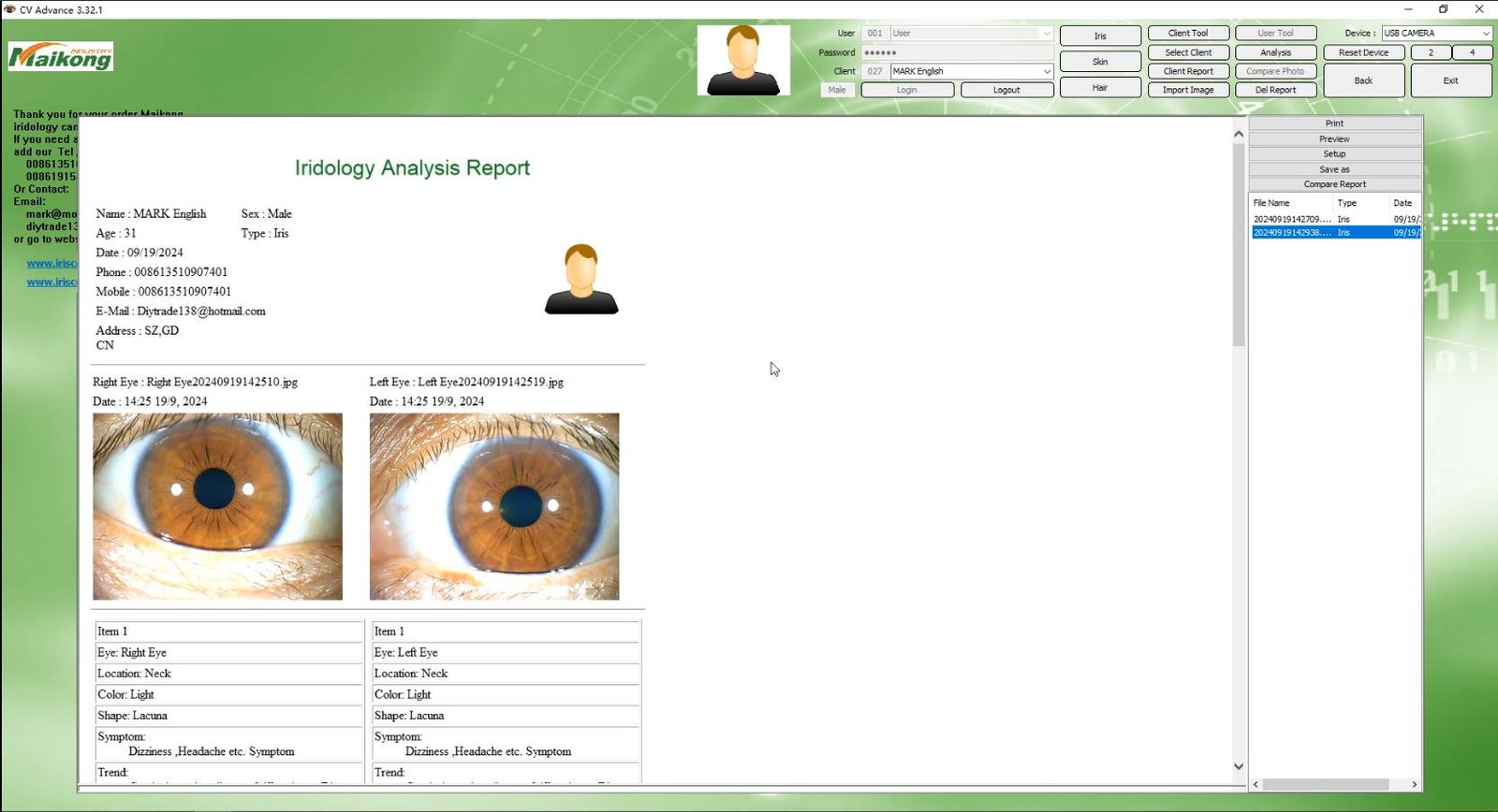 How To USE MAIKONG IRIDOLOGY SOFTWARE 2025 English Version 035