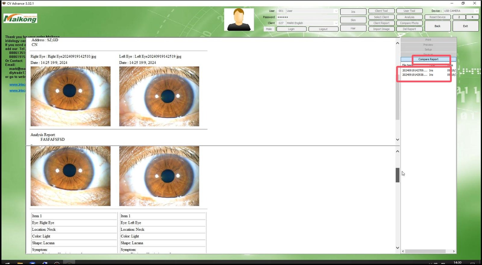 How To USE MAIKONG IRIDOLOGY SOFTWARE 2025 English Version 036