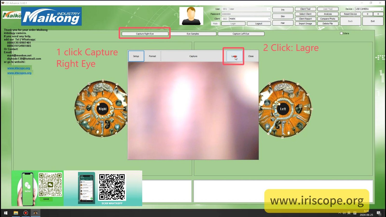 How To USE MAIKONG IRIDOLOGY SOFTWARE 2025 English Version008