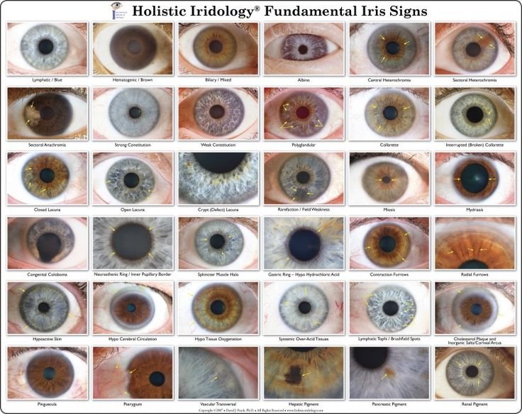 What Are Irides
