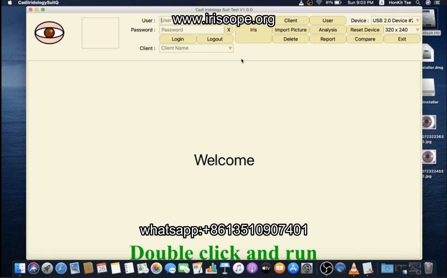 How to use maikong iridology software in apple mac os 004