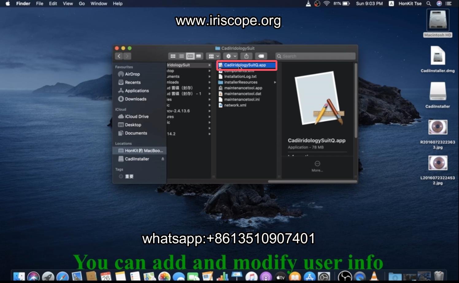 How to use maikong iridology software in apple mac os 008