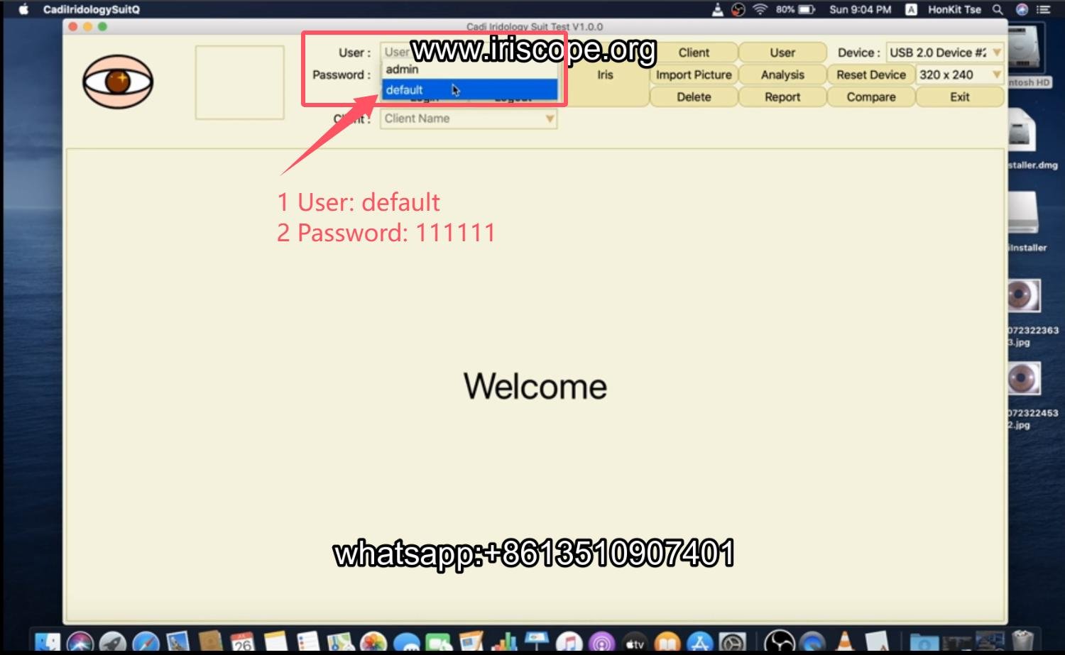 How to use maikong iridology software in apple mac os 009