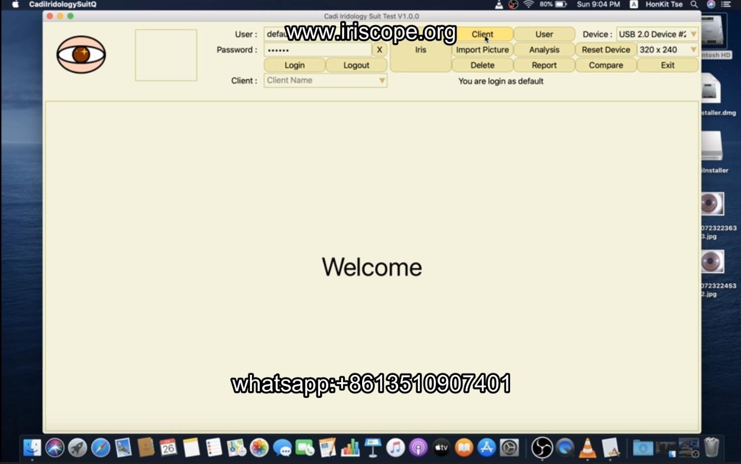 How to use maikong iridology software in apple mac os 010