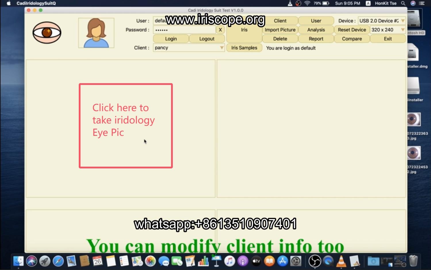 How to use maikong iridology software in apple mac os