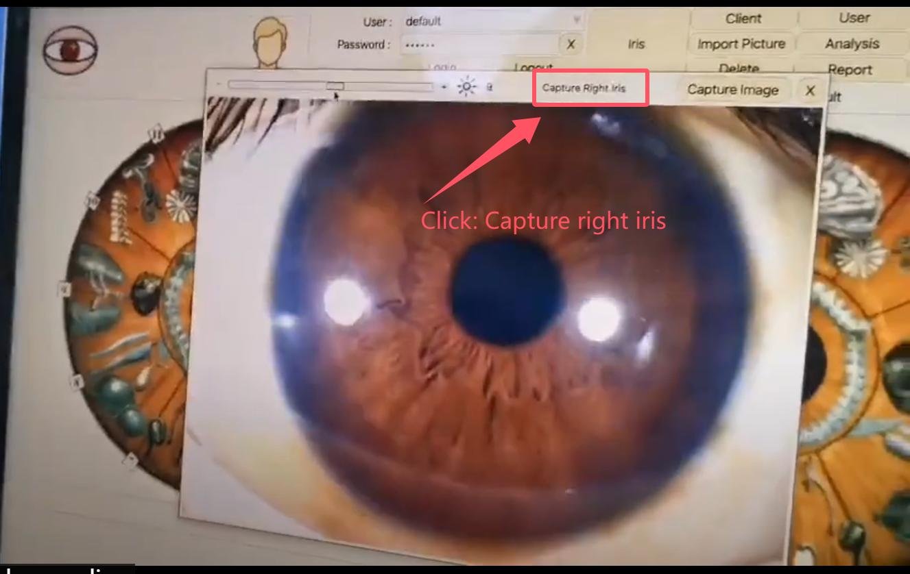 How to use maikong iridology software in apple mac os