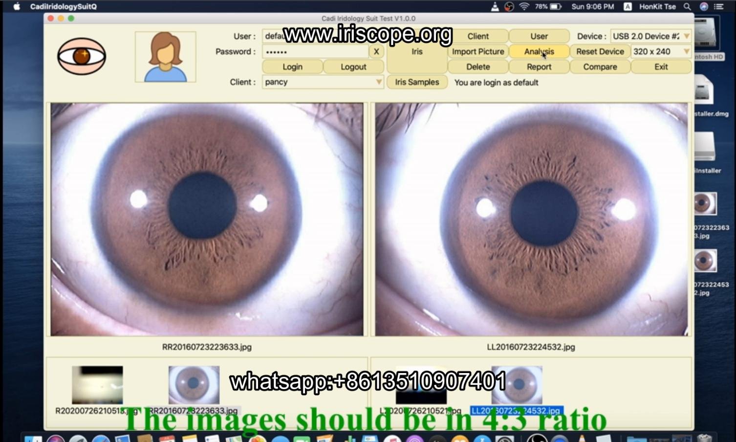 How to use maikong iridology software in apple mac os