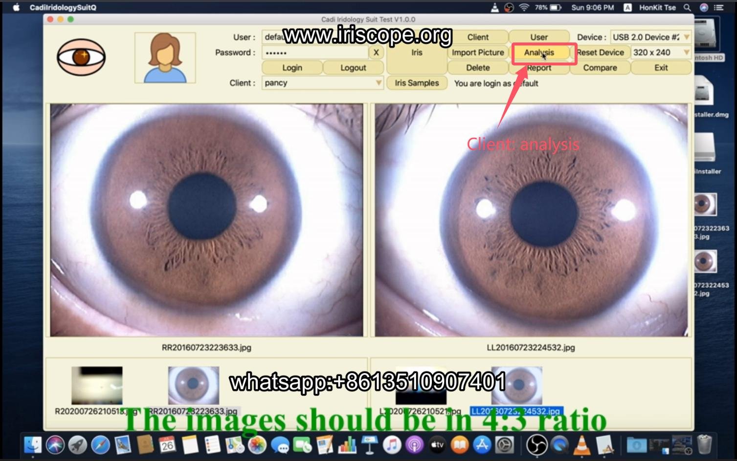 How to use maikong iridology software in apple mac os