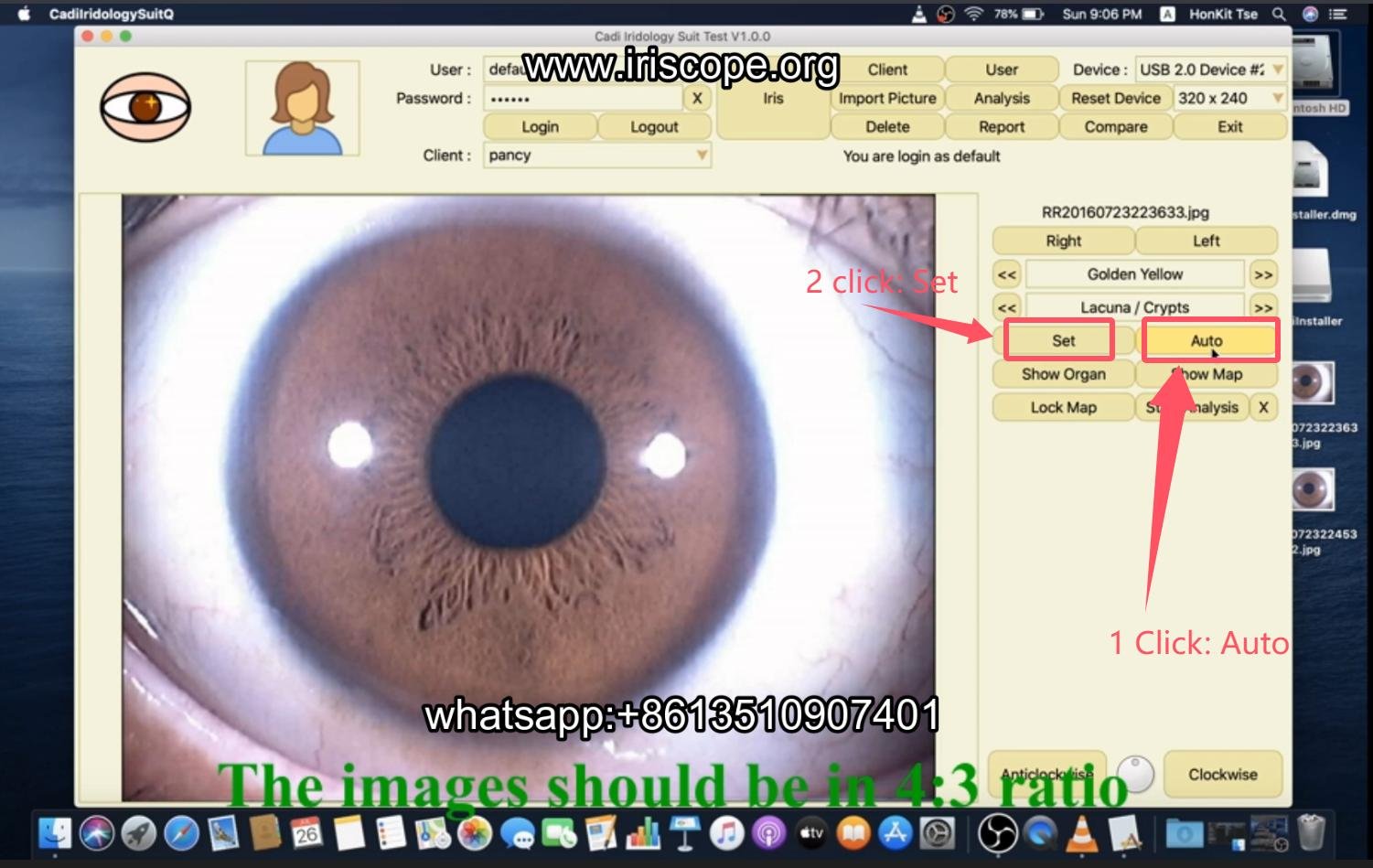 How to use maikong iridology software in apple mac os