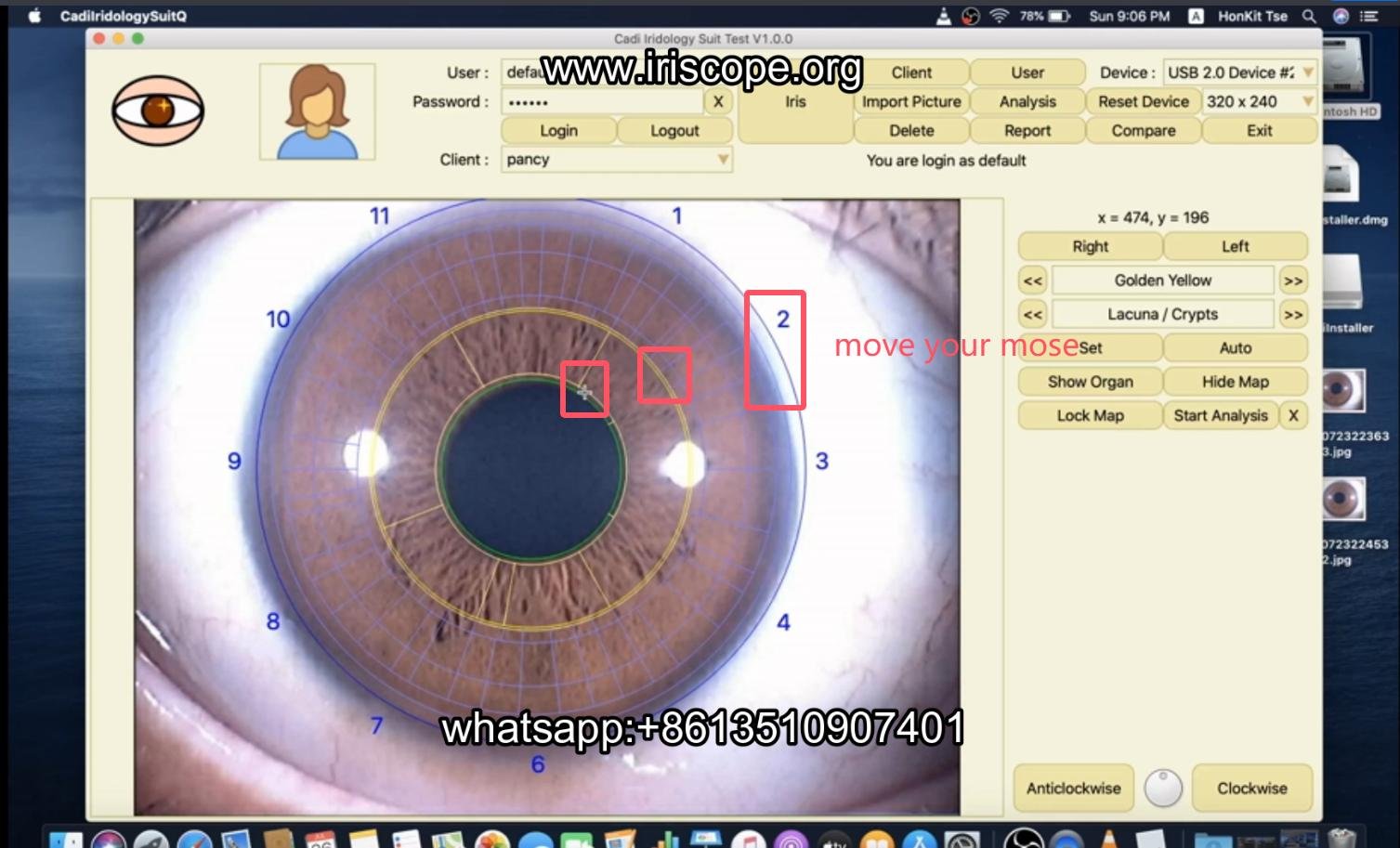 How to use maikong iridology software in apple mac os