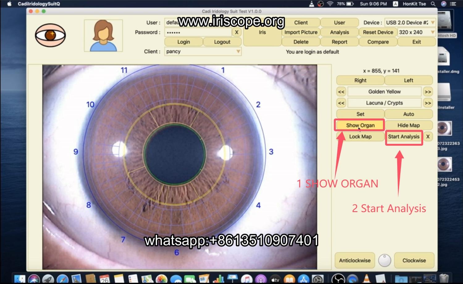 How to use maikong iridology software in apple mac os