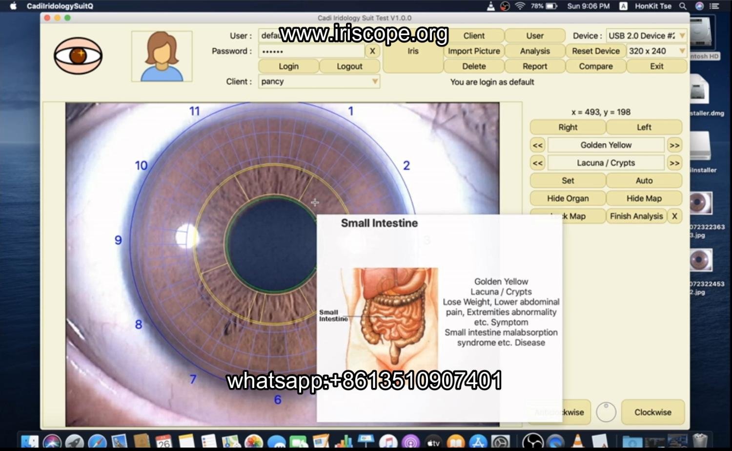 How to use maikong iridology software in apple mac os